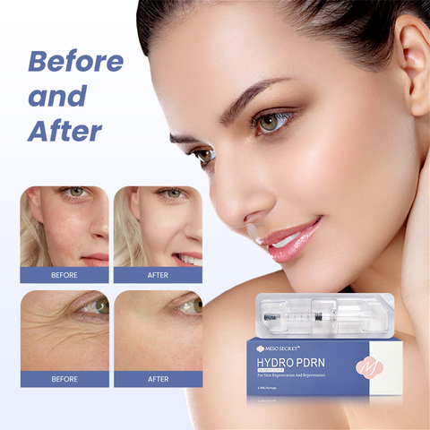 Newest Skinbooster Hydro PDRN for Skin Regeneration and Rejuvenation